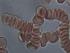Glóbulos rojos en pilas de moneda Glóbulos rojos en pilas de moneda